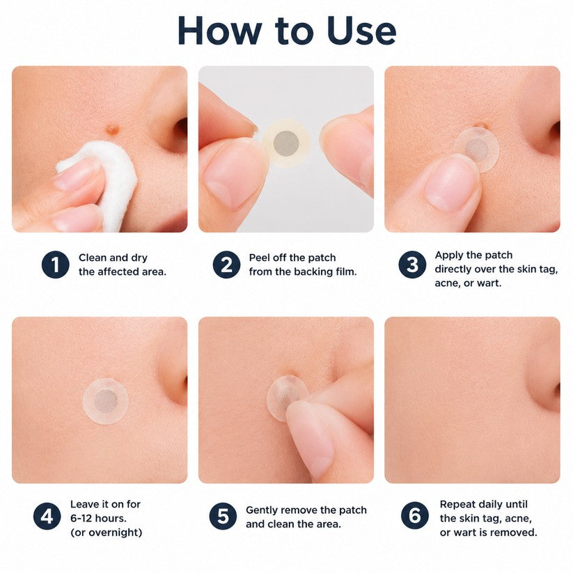 Tryourplus® 2-in-1 Microneedle & Hydrocolloid Patch 🌿 Invisible Face & Body Patches for Raised Moles, Acne, Flat Warts & Skin Tags - Helps Improve the Appearance of Wrinkles, Scars & Blemishes