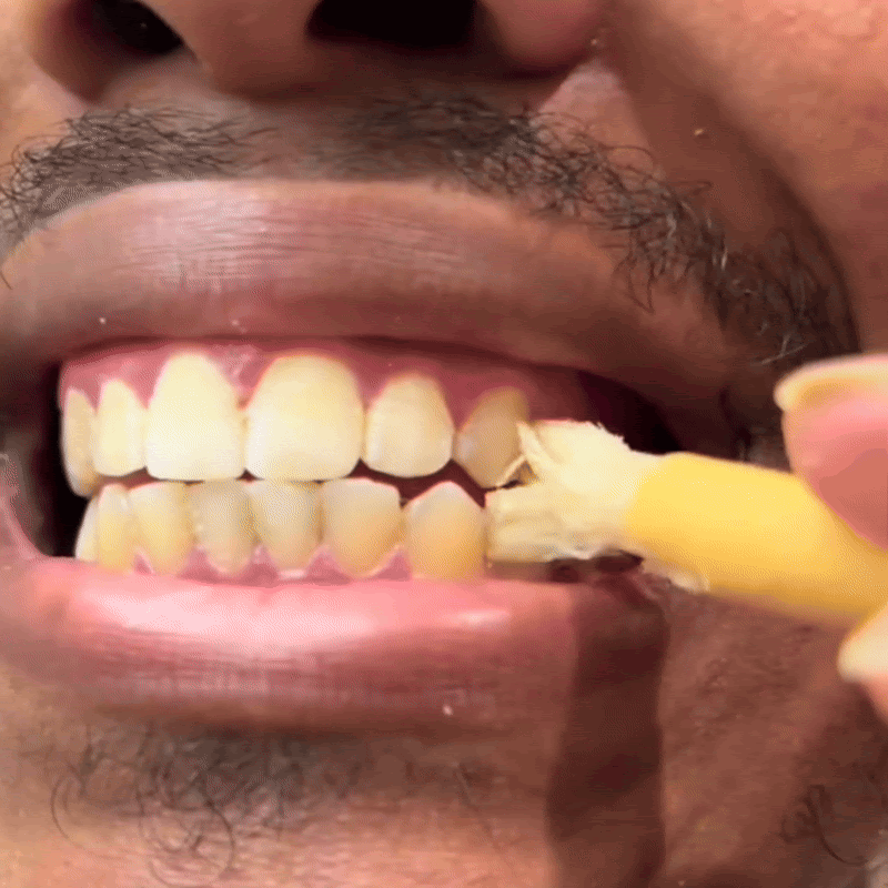 Miswak - Nature's Original Toothbrush